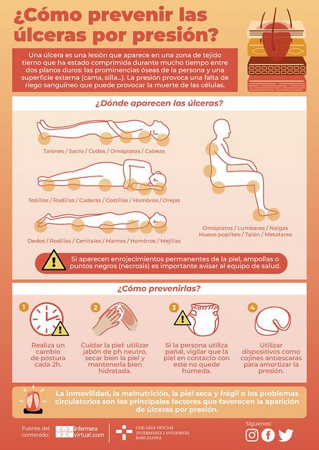 Infografía mostrando las zonas comunes donde aparecen úlceras por presión y ejemplos de dispositivos de prevención