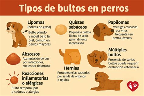 Infografía: Tipos comunes de bultos benignos en los senos