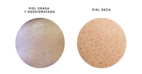 Comparación de piel seca y piel hidratada