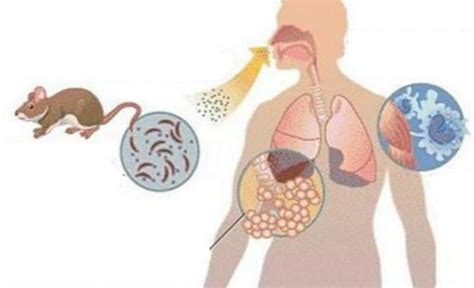 Esquema de las vías de transmisión del hantavirus por roedores y aerosoles