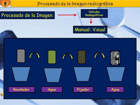 Esquema del proceso de revelado radiográfico