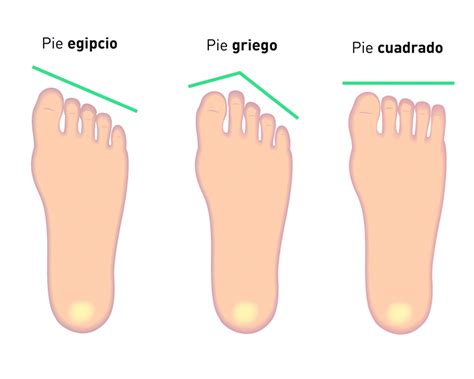 Esquema del pie egipcio mostrando el dedo gordo más largo