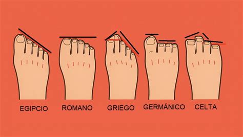 Ilustración del pie griego donde el segundo dedo es el más largo