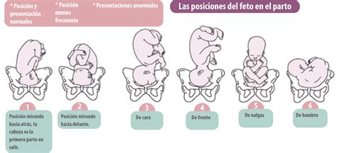 Diagrama: Bebé en posición cefálica de occipucio posterior