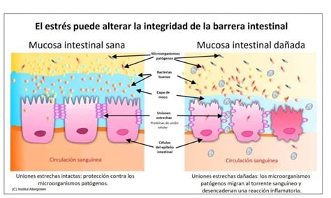 Esquema de la pared del intestino con permeabilidad aumentada, mostrando el daño causado por el gluten en la enfermedad celíaca.