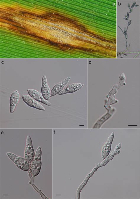 Micrografía de granos de arroz mostrando resistencia a Pyricularia oryzae.