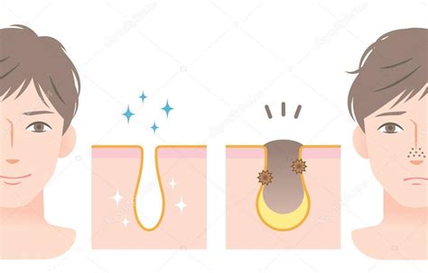 Microscopía de piel con poros limpios o exfoliación suave