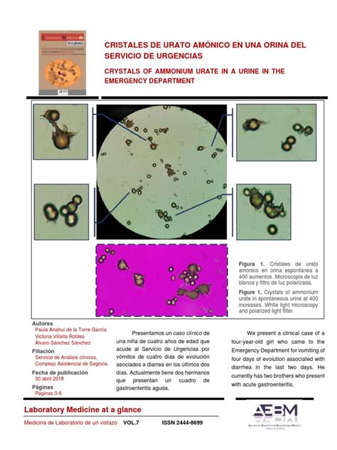 Infografía explicativa: Diferencia visual entre orina con cristales de urato (aspecto de arenilla) y orina con presencia de sangre.