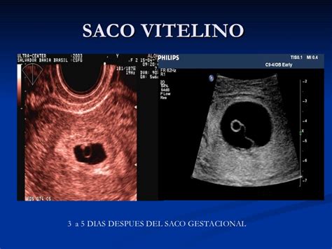 Alevín con saco vitelino