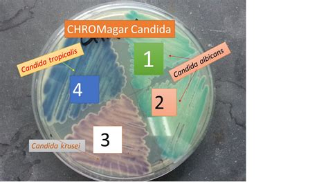 Placa de cultivo CHROMagar Candida mostrando colonias de diferentes colores para identificación de levaduras