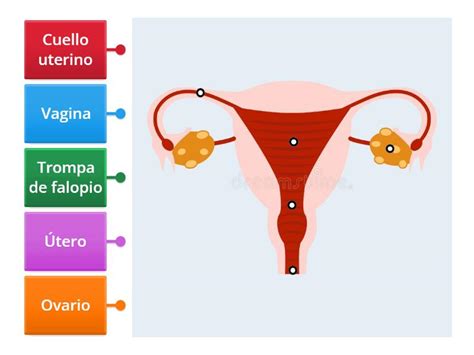 Diagrama del sistema reproductor femenino mostrando la posible propagación de una infección desde el cuello uterino al útero, trompas y ovarios.