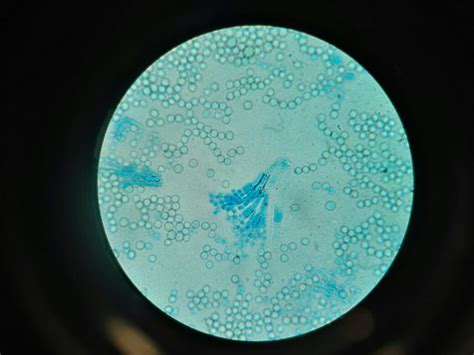 Espectro de colores generados a partir de cepas de Penicillium roqueforti modificadas
