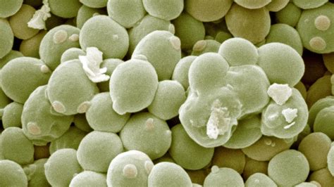 Comparación visual de una célula de Saccharomyces cerevisiae (2000x) con bacterias E. coli.