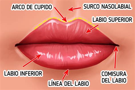Esquema de un labio con diferentes zonas de inflamación