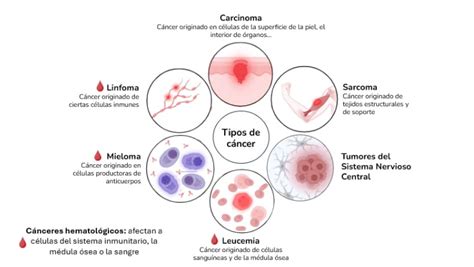 Imagen de los diferentes tipos de cáncer bucal
