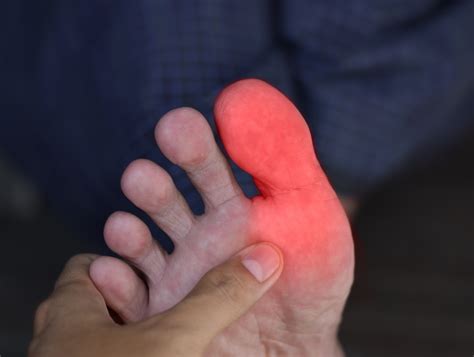Infografía comparativa: causas mecánicas vs. inflamatorias del dolor en el dedo gordo del pie