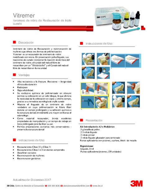 Infografía paso a paso del proceso de mezcla y aplicación del Vitremer, mostrando la consistencia ideal y las opciones de curado.
