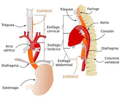 Esquema anatómico mostrando la separación entre los cabos superior e inferior del esófago en casos de atresia tipo long gap.
