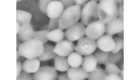 Imagen de levaduras Atecrem observadas con microscopía electrónica (x15k)