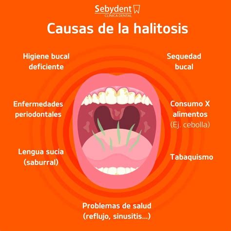 Esquema educativo que muestra las causas comunes de la halitosis: dentales, digestivas y metabólicas.