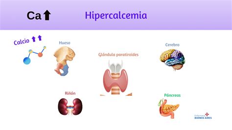 Ilustración de los síntomas musculares y neurológicos de la hipocalcemia