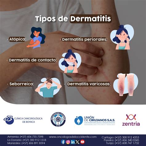 Infografía comparativa de los diferentes tipos de dermatitis en las manos, destacando sus características distintivas.