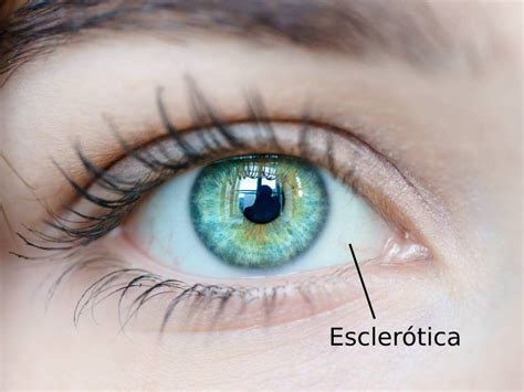 ilustración de un ojo humano mostrando la esclerótica, la conjuntiva y posibles tipos de manchas