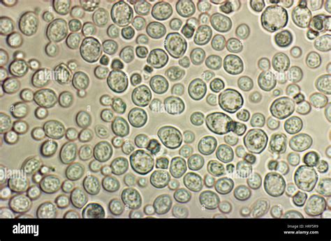Micrografía de levadura Saccharomyces cerevisiae.