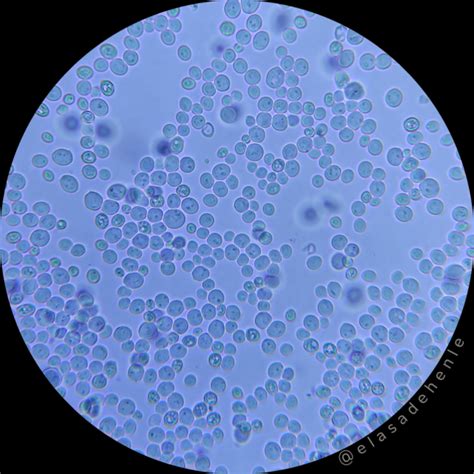 Microscopio mostrando levaduras Saccharomyces cerevisiae