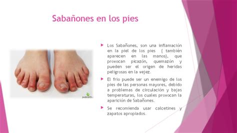 Ilustración de sabañones en los dedos del pie