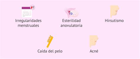 Infografía detallando los síntomas físicos más comunes del SOP: acné, hirsutismo, irregularidades menstruales y acantosis nigricans.