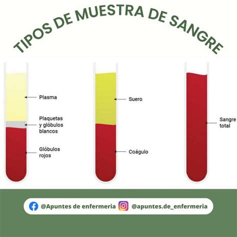 Ilustración de diferentes tipos de muestras para cultivos bacterianos (sangre, esputo, herida).